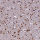 Immunohistochemical staining of human cerebral cortex shows strong cytoplasmic positivity in neurons.