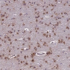 Immunohistochemical staining of human cerebral cortex shows strong cytoplasmic positivity in neurons.