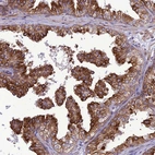 Immunohistochemical staining of human prostate shows strong cytoplasmic positivity in glandular cells.