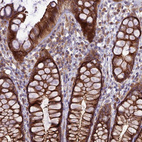 Immunohistochemical staining of human rectum shows strong cytoplasmic positivity in glandular cells.