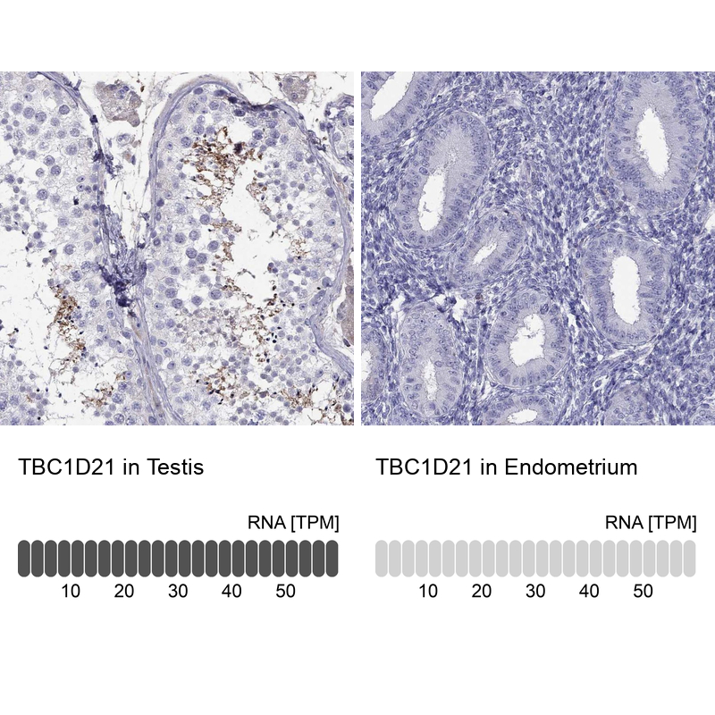 Anti-TBC1D21 Antibody