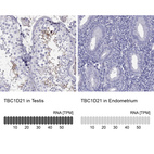 Anti-TBC1D21 Antibody