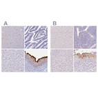 Immunohistochemical staining of human cerebral cortex, endometrium, liver and urinary bladder using Anti-UPK2 antibody HPA043312 (A) shows similar protein distribution across tissues to independent antibody HPA061106 (B).