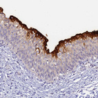 Immunohistochemical staining of human urinary bladder shows strong membranous positivity in urothelial cells.