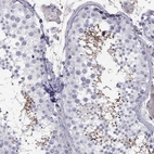 Immunohistochemical staining of human testis shows high expression.