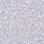 Immunohistochemical staining of human liver shows no positivity in hepatocytes as expected.
