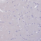 Immunohistochemical staining of human cerebral cortex shows no positivity in neurons as expected.