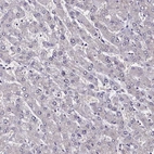 Immunohistochemical staining of human liver shows low expression as expected.