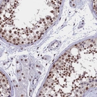 Immunohistochemical staining of human testis shows high expression.