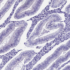 Immunohistochemical staining of human endometrium shows no positivity in glandular cells as expected.