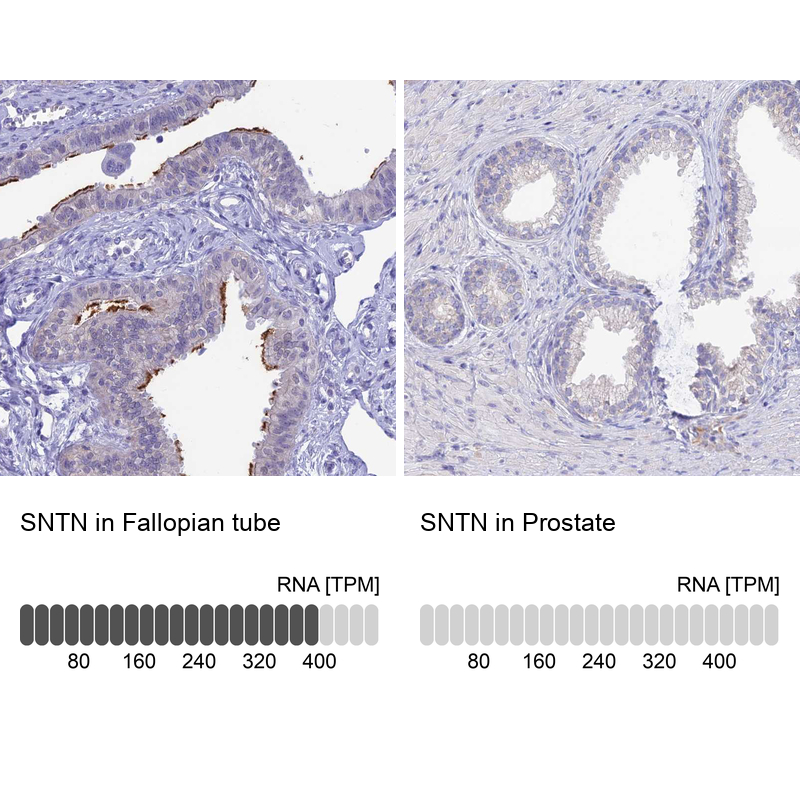 Anti-SNTN Antibody