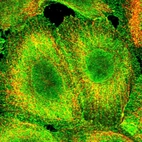 Immunofluorescent staining of human cell line A-431 shows localization to nucleoplasm, plasma membrane & cytosol.