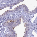 Immunohistochemical staining of human fallopian tube shows strong positivity in cilia in glandular cells.