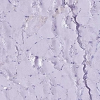 Immunohistochemical staining of human skeletal muscle shows negative cytoplasmic positivity in myocytes as expected.