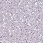 Immunohistochemical staining of human liver shows negative cytoplasmic positivity in hepatocytes as expected.
