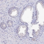 Immunohistochemical staining of human prostate shows negative cytoplasmic positivity in glandular cells as expected.