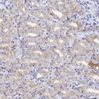 Immunohistochemical staining of human stomach shows weak cytoplasmic positivity in parietal cells.