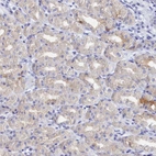 Immunohistochemical staining of human stomach shows weak cytoplasmic positivity in parietal cells.