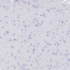 Immunohistochemical staining of human cerebral cortex shows no cytoplasmic positivity in neuronal cells as expected.
