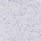 Immunohistochemical staining of human cerebral cortex shows no cytoplasmic positivity in neuronal cells as expected.