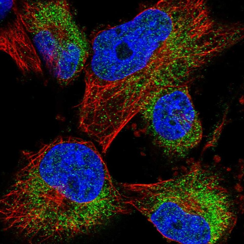 Anti-ACBD7 Antibody