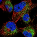 Anti-ACBD7 Antibody