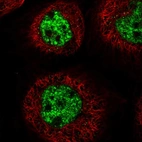 Immunofluorescent staining of human cell line A-431 shows localization to nuclear speckles.