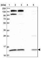 Lane 1: Marker [kDa] 250, 130, 95, 72, 55, 36, 28, 17, 10_br/_Lane 2: Human cell line RT-4_br/_Lane 3: Human cell line U-251MG sp_br/_Lane 4: Human plasma (IgG/HSA depleted)_br/_Lane 5: Human liver tissue