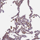 Anti-TMEM255B Antibody