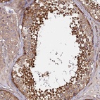 Anti-GNL1 Antibody