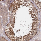 Anti-GNL1 Antibody