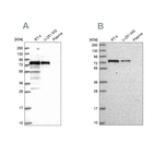 Western blot analysis using Anti-GNL1 antibody HPA043338 (A) shows similar pattern to independent antibody HPA050455 (B).