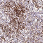 Anti-SREBF1 Antibody