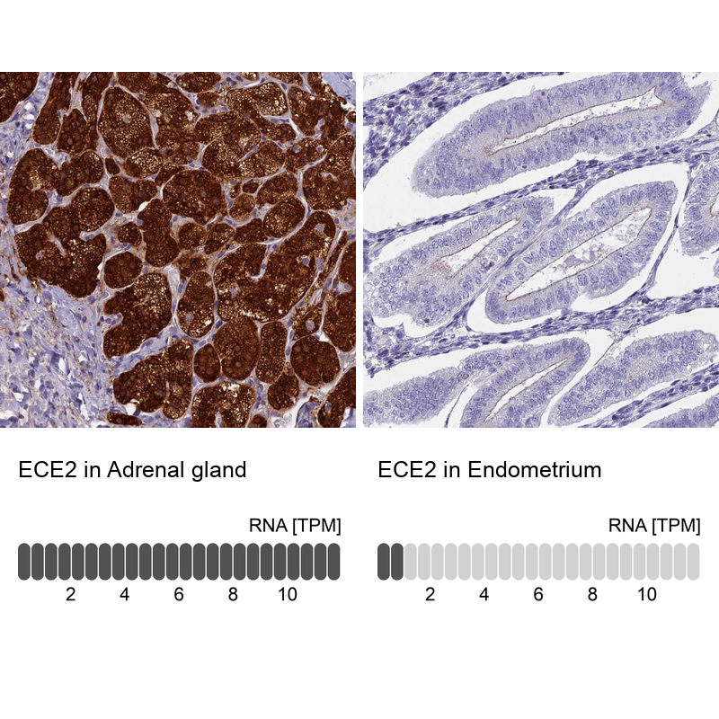 Anti-ECE2 Antibody
