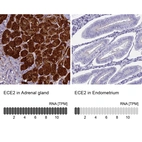 Anti-ECE2 Antibody