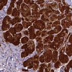 Immunohistochemical staining of human adrenal gland shows high expression.