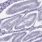 Immunohistochemical staining of human endometrium shows low expression as expected.