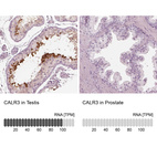 Anti-CALR3 Antibody