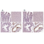 Immunohistochemical staining of human colon, liver, prostate and testis using Anti-CALR3 antibody HPA043355 (A) shows similar protein distribution across tissues to independent antibody HPA048460 (B).