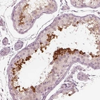 Immunohistochemical staining of human testis shows strong cytoplasmic positivity in spermatids.