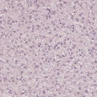Immunohistochemical staining of human liver shows no positivity in hepatocytes as expected.