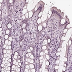 Immunohistochemical staining of human colon shows no positivity in glandular cells as expected.