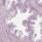 Immunohistochemical staining of human prostate shows no positivity in glandular cells as expected.