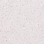 Immunohistochemical staining of human cerebral cortex shows moderate cytoplasmic positivity in neurons.
