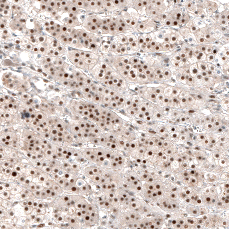 Anti-NR4A3 Antibody