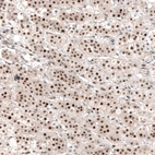Anti-NR4A3 Antibody