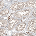 Immunohistochemical staining of human testis shows strong cytoplasmic positivity in Leydig cells.