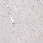 Immunohistochemical staining of human skeletal muscle shows no positivity in myocytes as expected.