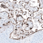 Immunohistochemical staining of human placenta shows strong nuclear positivity in trophoblastic cells.