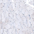 Immunohistochemical staining of human skeletal muscle shows very weak to weak nuclear positivity in myocytes.